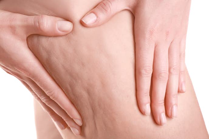50代女性のお腹周りの脂肪が落ちない原因｜セルライトが出来てしまっている