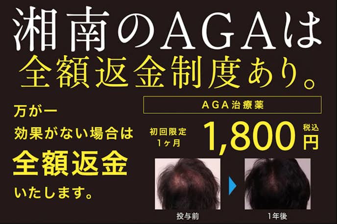 埼玉県のおすすめagaクリニック22選 薄毛治療の評判や口コミが良い病院とは Smartlog