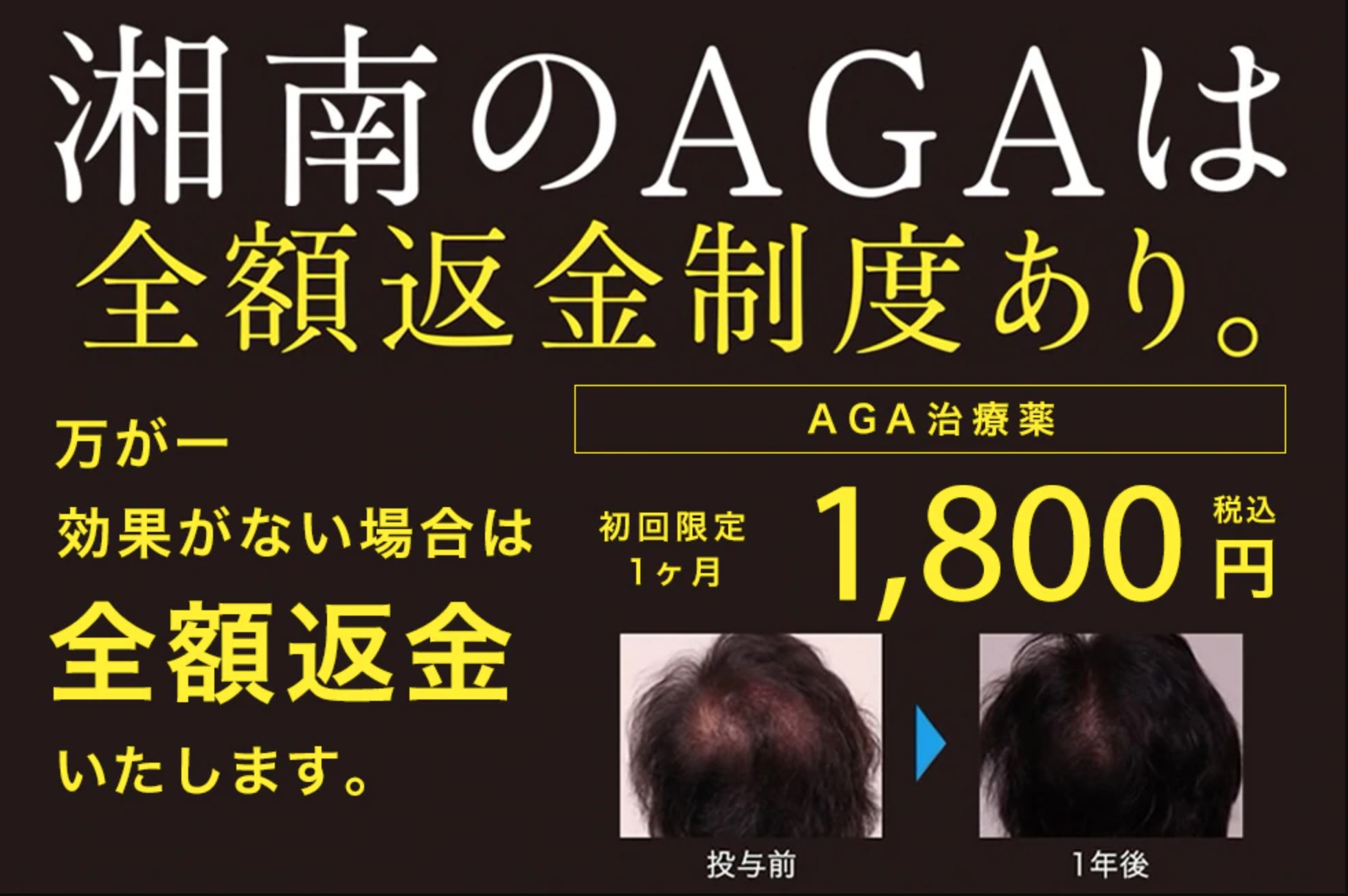 大阪でおすすめのAGAクリニックは湘南メディカルクリニック