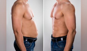 男性で体脂肪率15 は痩せてる もっと脂肪を減らして細マッチョになる方法を解説 Smartlog