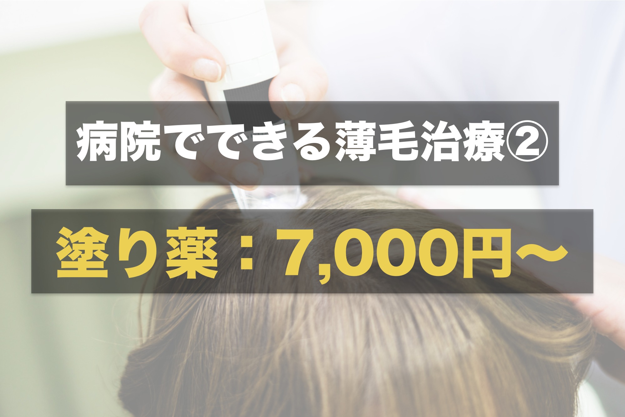 AGAクリニックの治療方法：外用薬