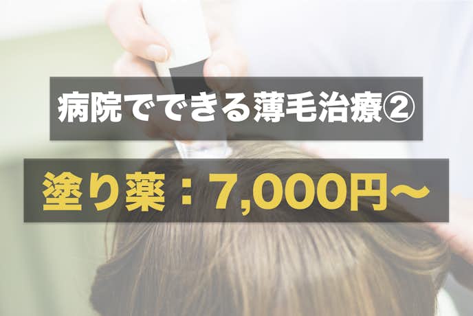 AGAクリニックの治療方法:外用薬