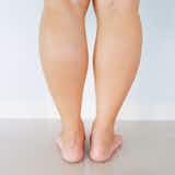 【遺伝ではない？】足が太い5つの原因｜下半身太りを解消する10の方法を紹介！