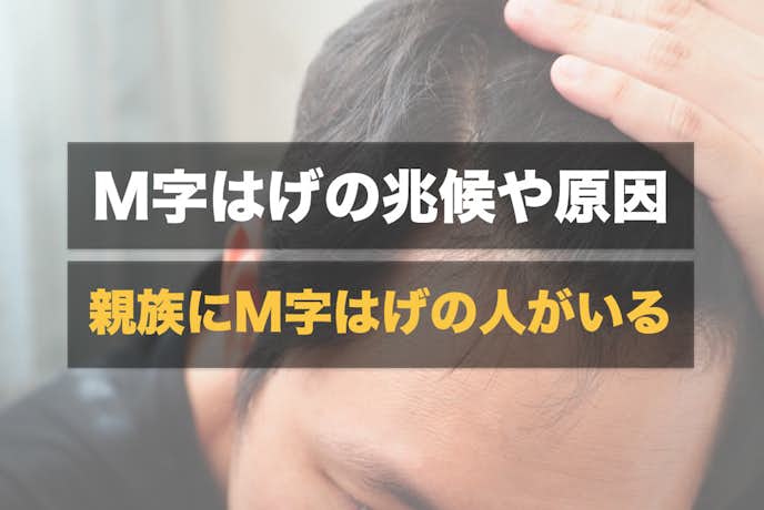 M字はげの特徴や見分け方 薄毛 抜け毛の兆候 生え際の後退原因と対策も解説 Smartlog M字はげの特徴や見分け方 薄毛 抜け毛の兆候 生え際の後退原因と対策も解説 Smartlog