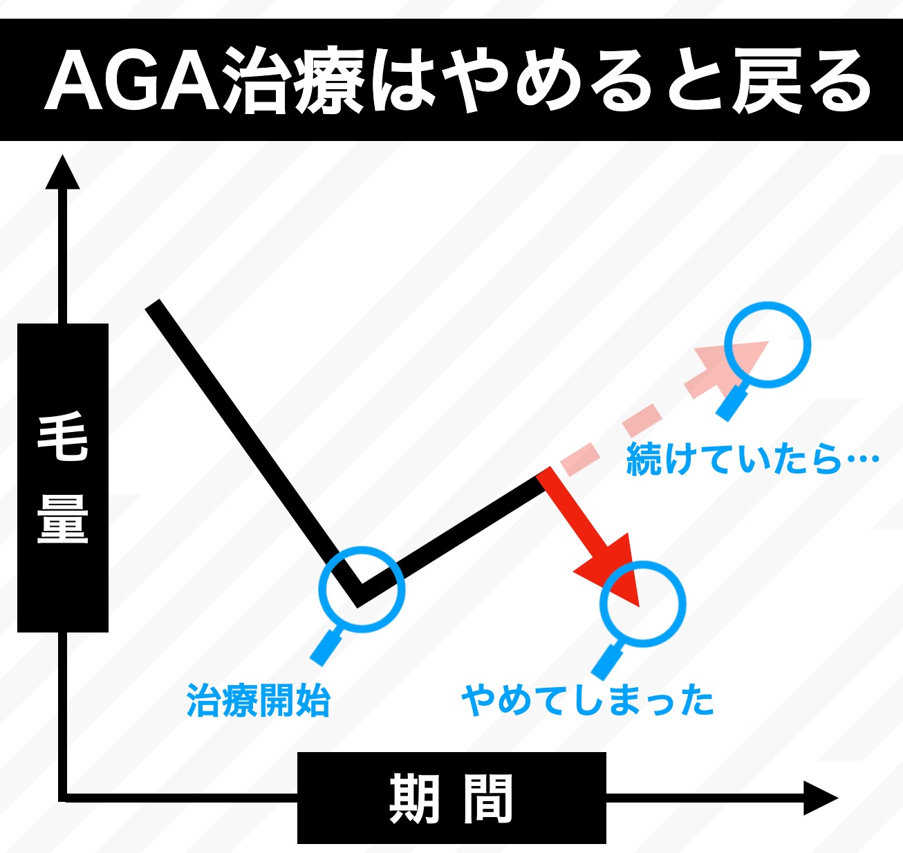 aga治療はやめると元に戻る