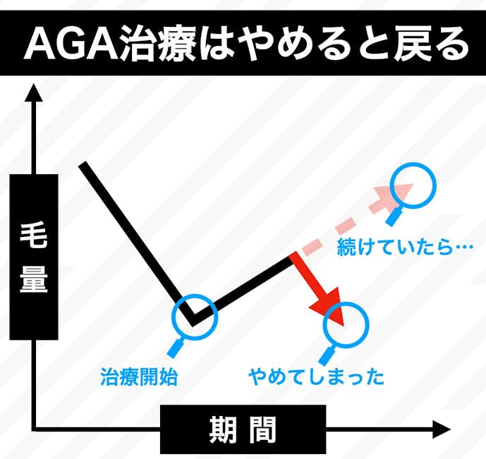 aga治療はやめると元に戻る