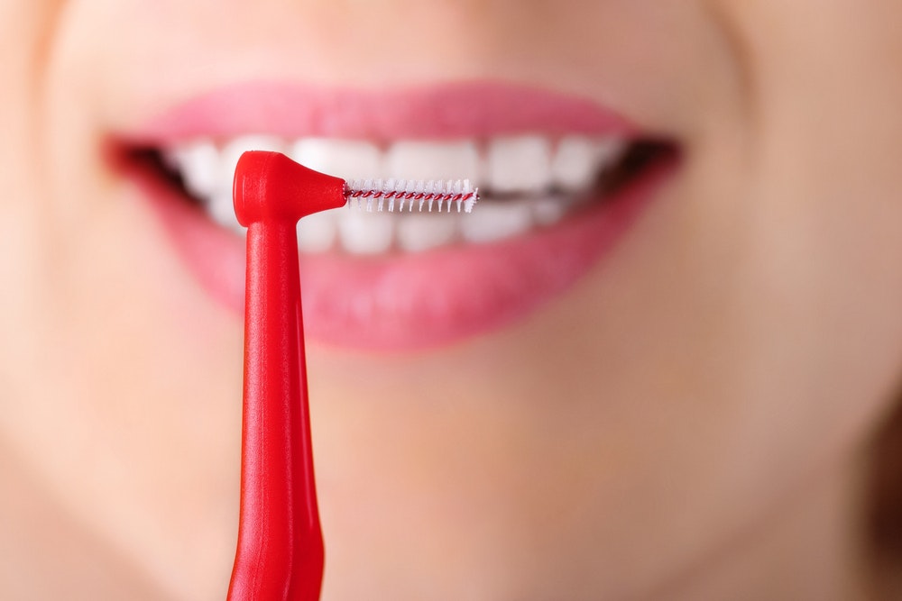 歯間ブラシのおすすめ25選｜歯の隙間の汚れを落としやすい人気商品を紹介！ | Smartlog