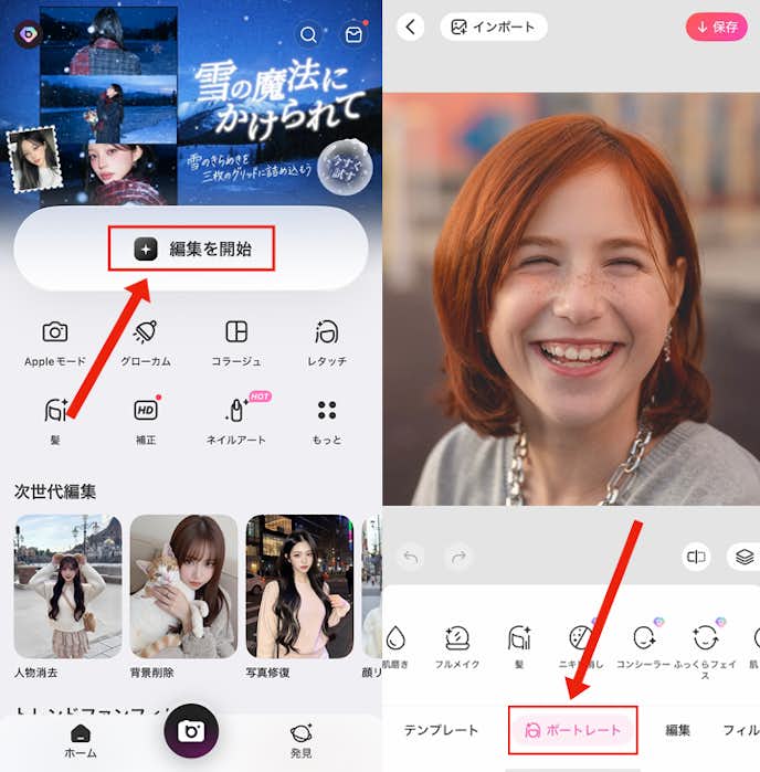 顔の傷を消す方法①