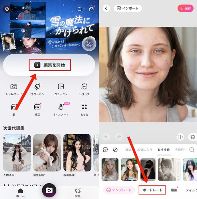 ニキビを消す方法①