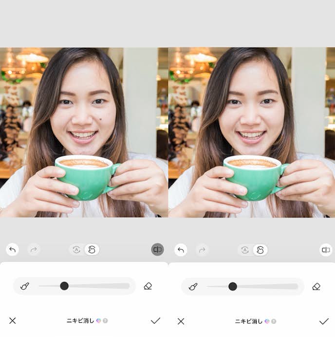 ほくろを消す方法④