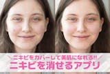 【無料】写真からニキビを消すアプリおすすめ...