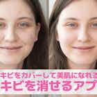 【無料】写真からニキビを消すアプリおすすめ8選。顔の吹き出物・ニキビ跡まで無くせる加工アプリ集