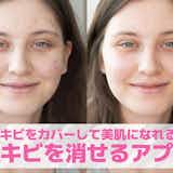 【無料】写真からニキビを消すアプリおすすめ8選。顔の吹き出物・ニキビ跡まで無くせる加工アプリ集