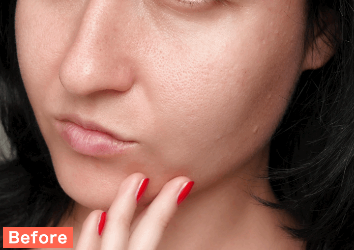 BeautyPlusで毛穴を消してみた