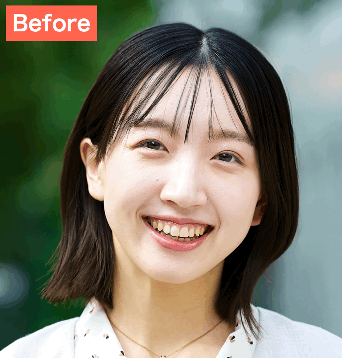 BeautyPlusで歯並びを補正した画像