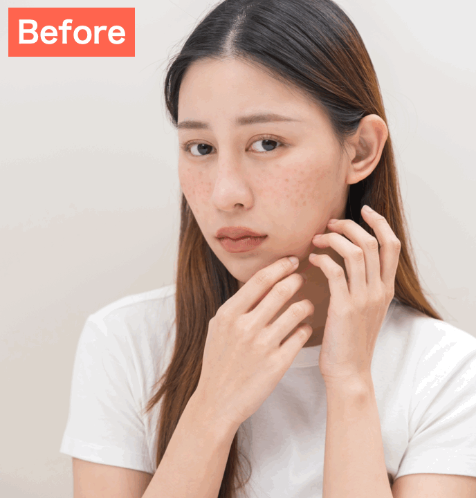 BeautyPlusで肌を綺麗にした画像