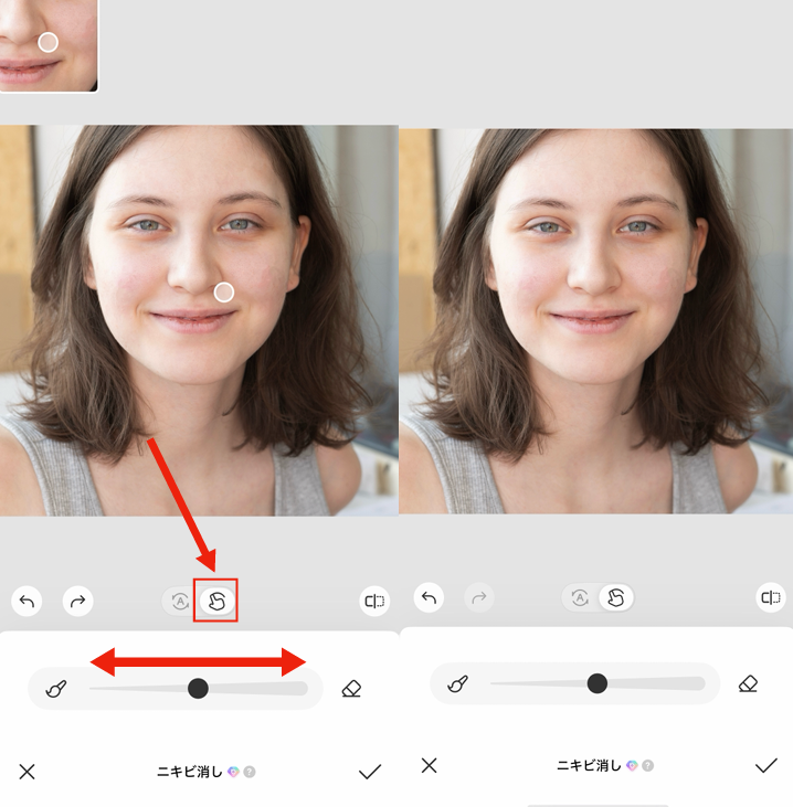 ニキビを消す方法③