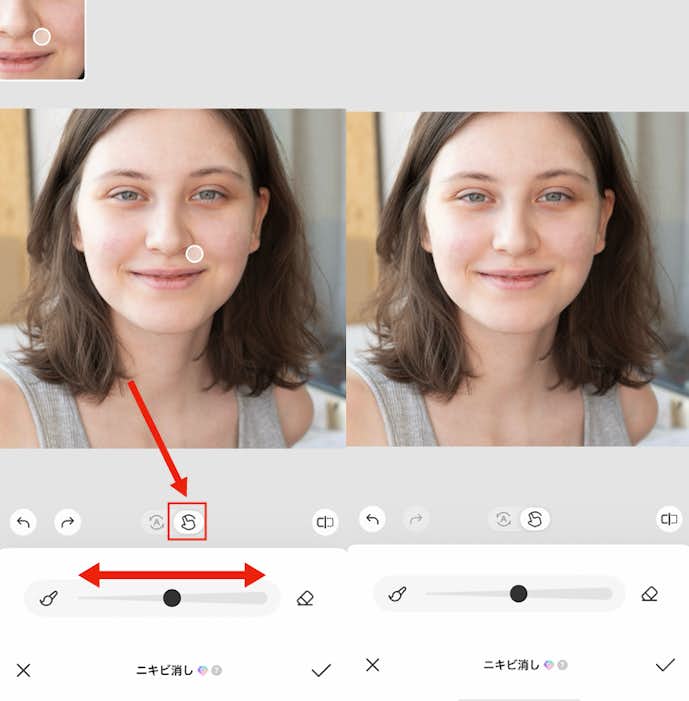ニキビを消す方法③