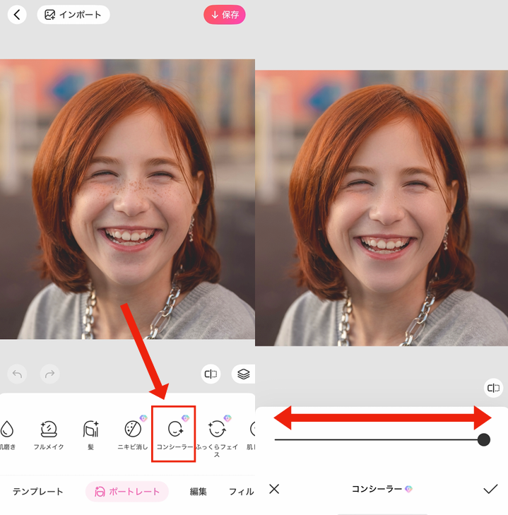 顔の傷を消す方法②