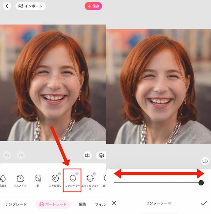顔の傷を消す方法②