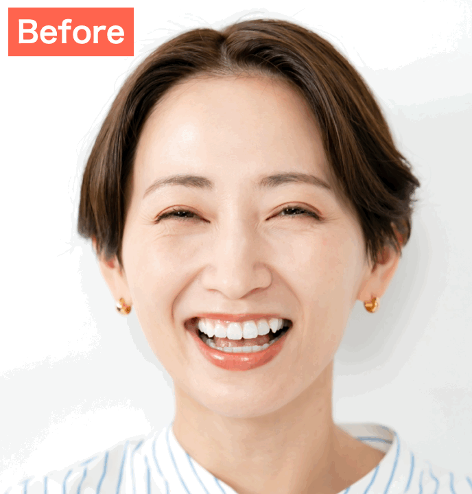 BeautyPlusで歯並びを補正した画像