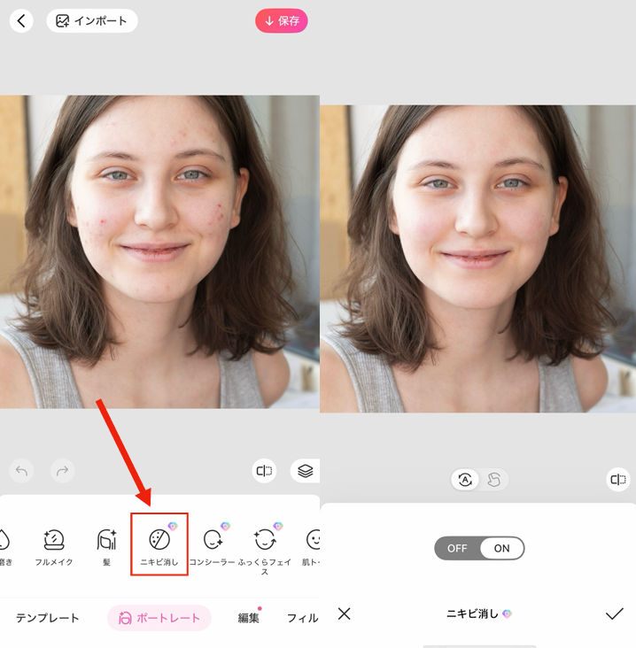 ニキビを消す方法②