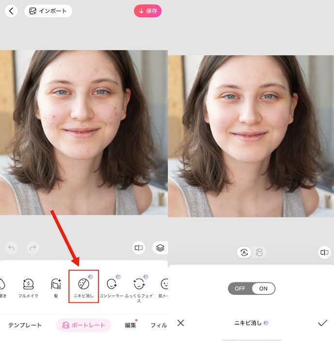 ニキビを消す方法②
