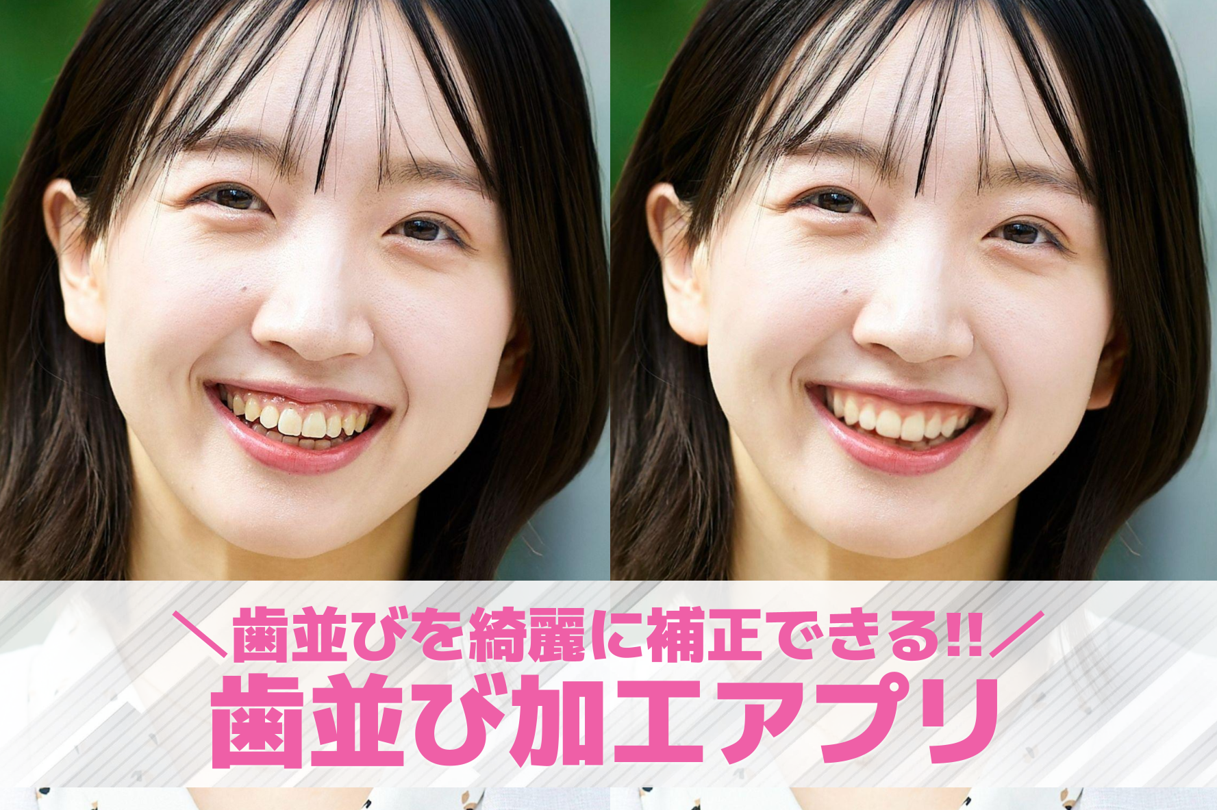 【無料】歯並び加工アプリおすすめ3選。歯並びを綺麗に補正する写真編集アプリを紹介！