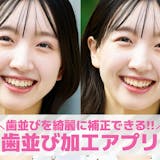 【無料】歯並びを綺麗にする加工アプリおすす...