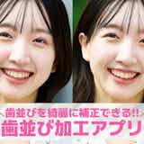 【無料】歯並び加工アプリおすすめ3選。歯並びを綺麗に補正する写真編集アプリを紹介!