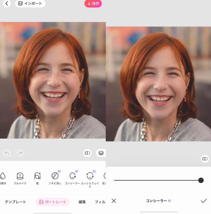 顔の傷を消す方法③
