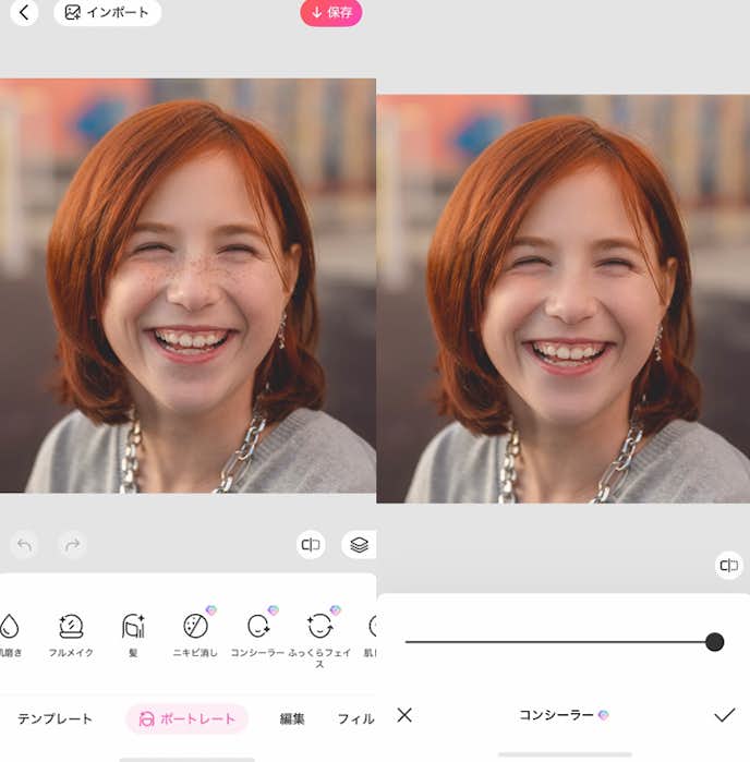 顔の傷を消す方法③