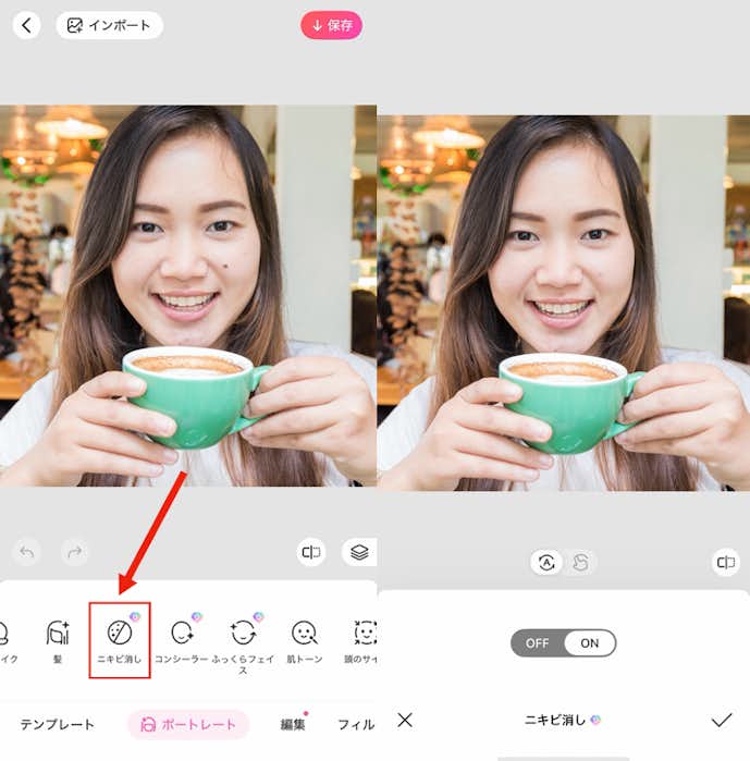 ほくろを消す方法②