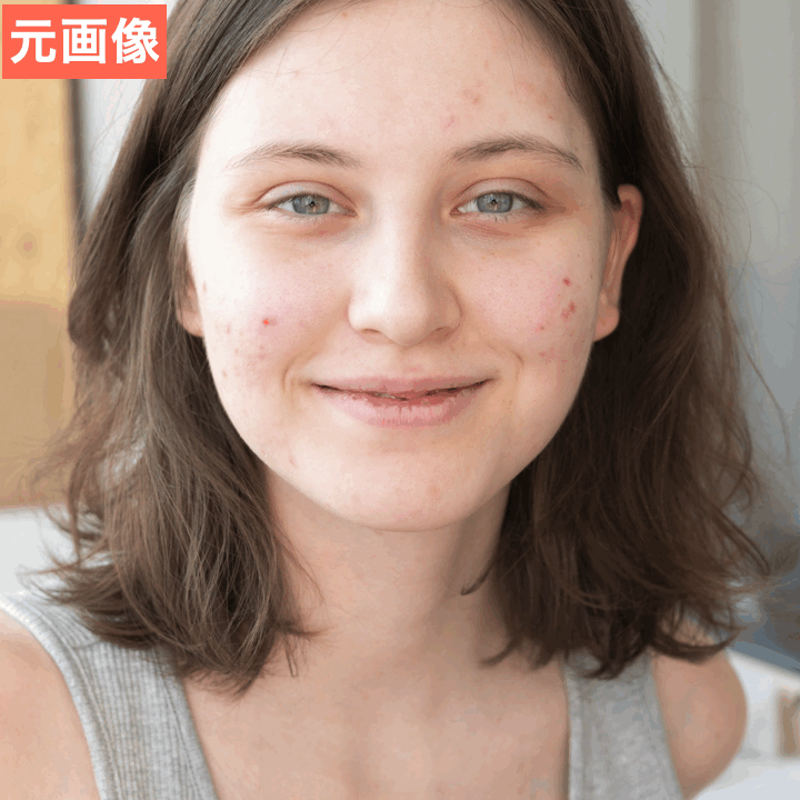 BeautyPlusでニキビを消してみた