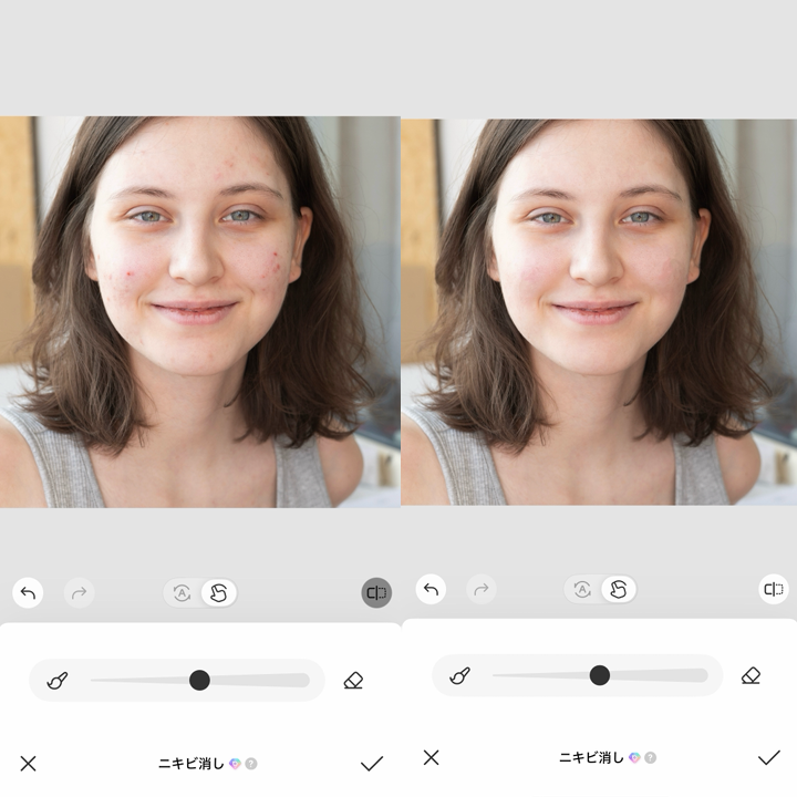 ニキビを消す方法④