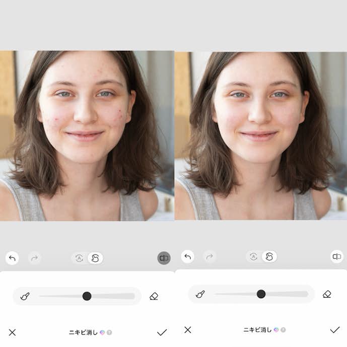 ニキビを消す方法④
