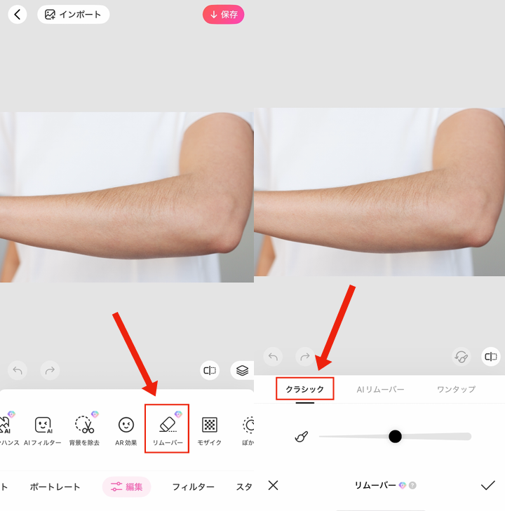 ムダ毛を消す方法②