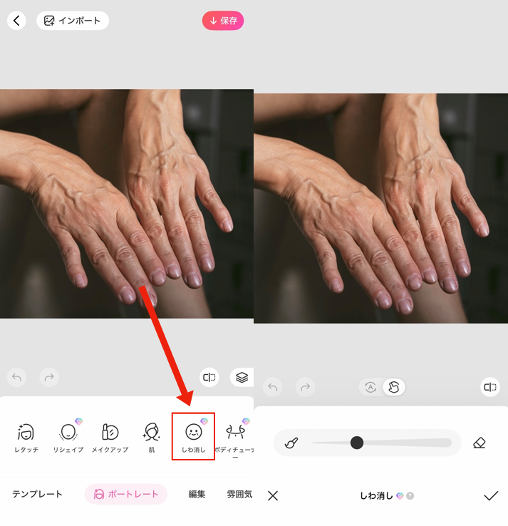 手のシワを消す方法