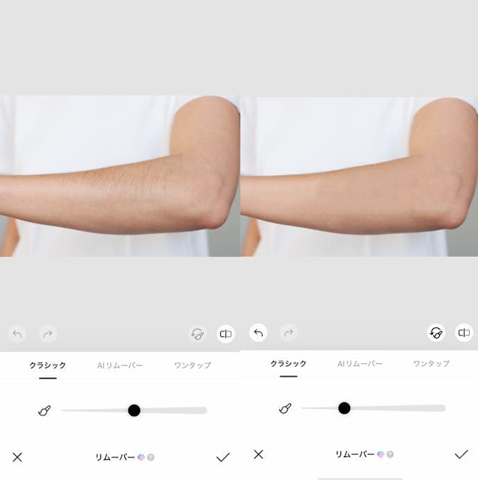 ムダ毛を消す方法④