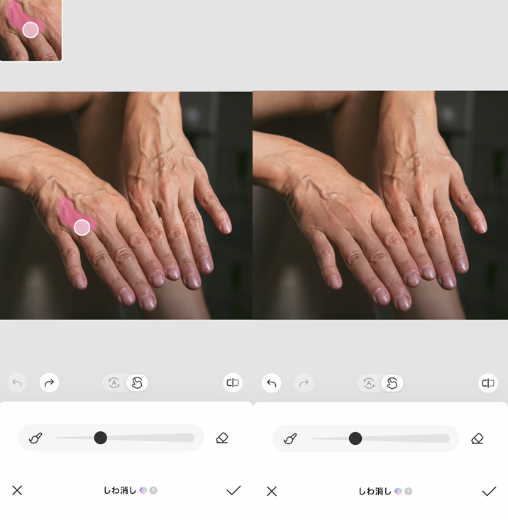 手のシワを消す方法