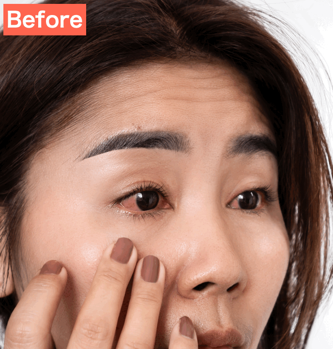 SNOWで充血した白目を綺麗にした画像