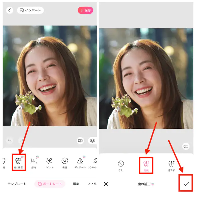 BeautyPlusの矯正機能で歯並びを整えてガミースマイルを補正する方法